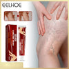 VARICOSE VEINS ORIGINAL Crema Para Las Venas Varices