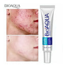 Crema Anti-Acné Bioaqua – Transformación Completa para Piel Grasa y Cicatrices