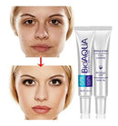 Crema Anti-Acné Bioaqua – Transformación Completa para Piel Grasa y Cicatrices